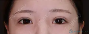 30 days after image