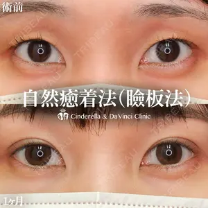 before image