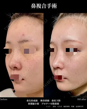 before image