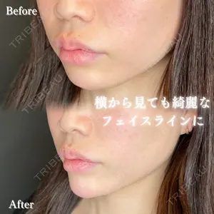 before image