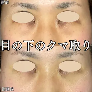 0 days after image