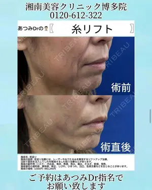30 days after image