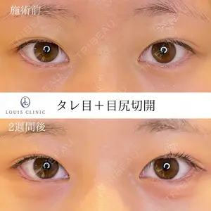 before image