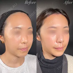 null days after image