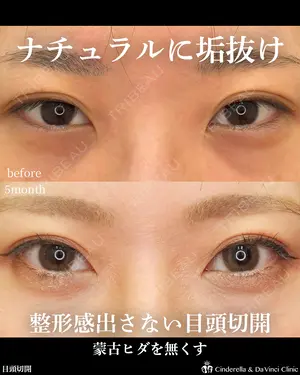 before image