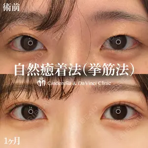 30 days after image