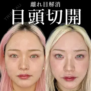 30 days after image
