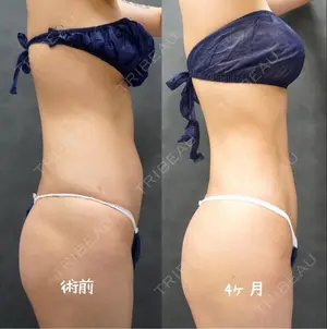 119 days after image