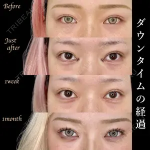 30 days after image