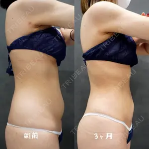 90 days after image