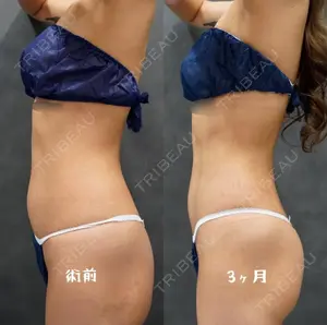 90 days after image