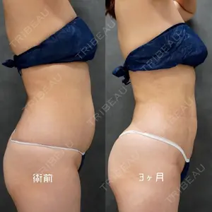 90 days after image