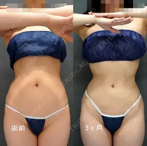 90 days after image