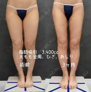 90 days after image