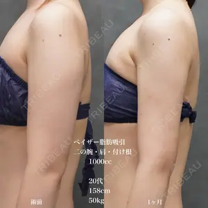 30 days after image