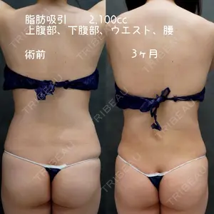90 days after image