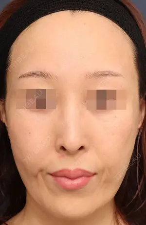 180 days after image