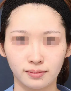 before image