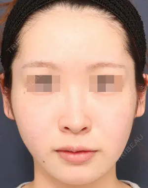 180 days after image