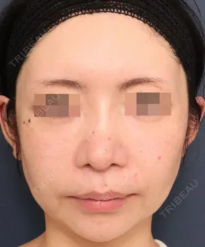 420 days after image