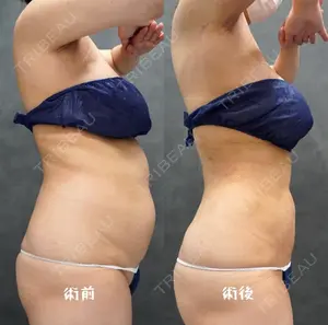 90 days after image