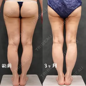 90 days after image