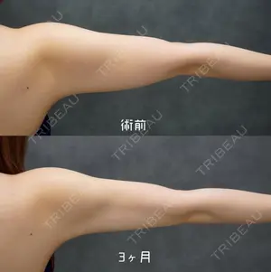 90 days after image