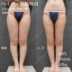 90 days after image