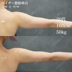 30 days after image