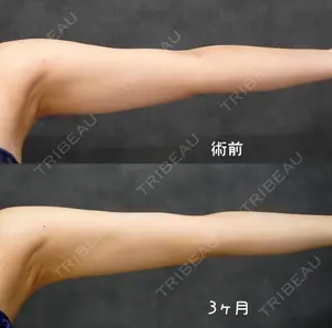 90 days after image
