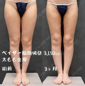 90 days after image