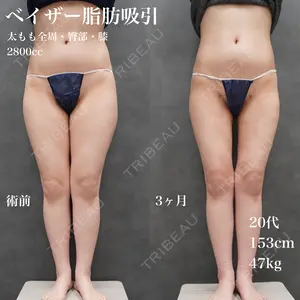 90 days after image