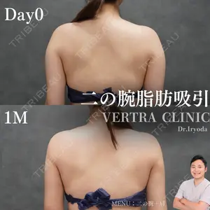 null days after image
