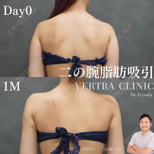 null days after image