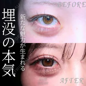 5 days after image