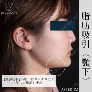 30 days after image
