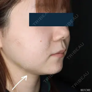 before image