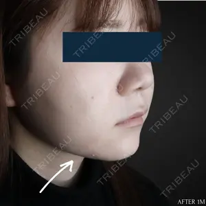 30 days after image