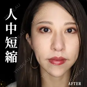 30 days after image