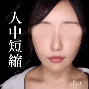 90 days after image