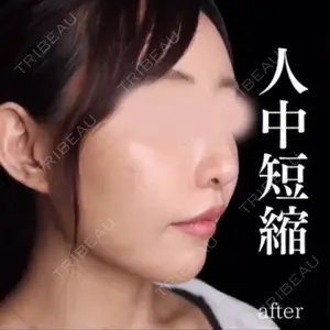 90 days after image