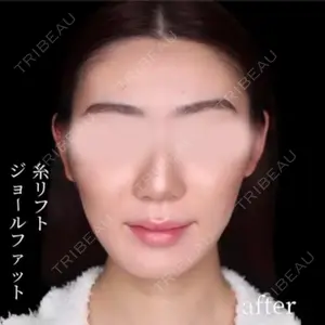 30 days after image