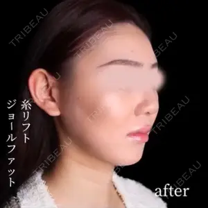 30 days after image