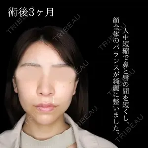 90 days after image