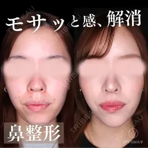90 days after image