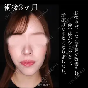 90 days after image