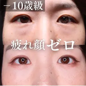 30 days after image