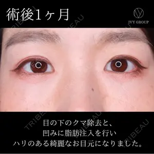 30 days after image