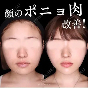 30 days after image
