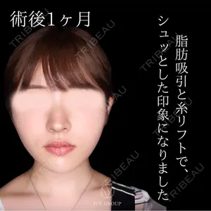 30 days after image
